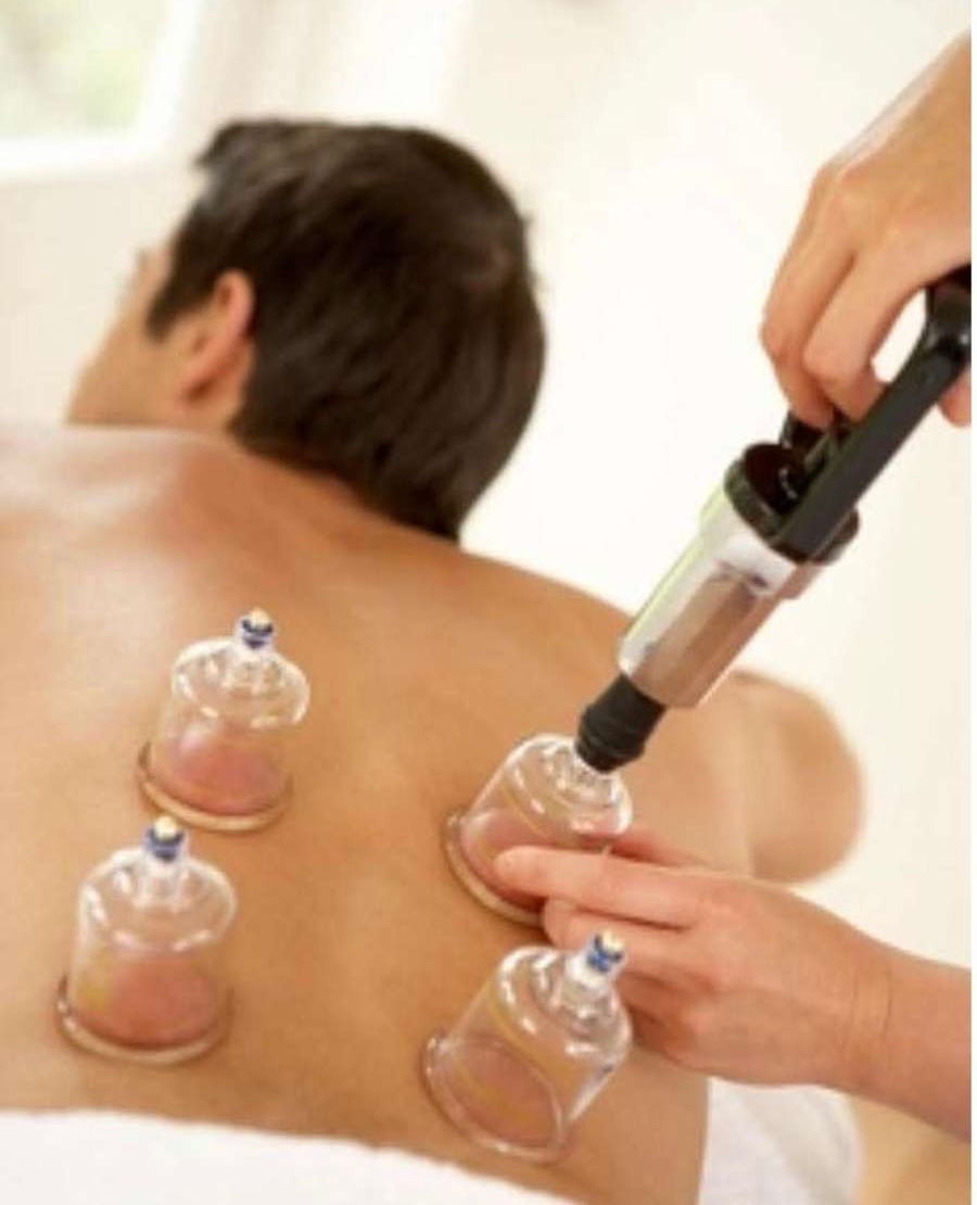 Ventouses corporelles Frésanté - Bien-être